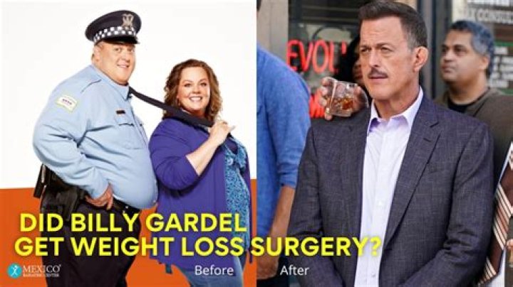 Bob Hearts Abishola: Is Billy Gardell Sick? Did He Undergo Bariatric Surgery? Details To Know